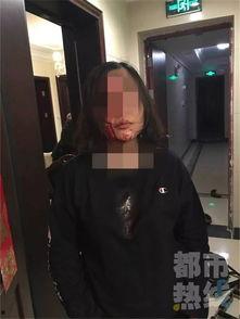 屁股被老公打的皮开肉绽,一段夫妻间的情感纠葛与反思