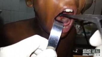 喉 在线播放,在线播放带你领略喉部知识之旅